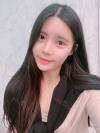 Double Eyelid Revision (Natural adhesion method+Ptosis correction+Dual Epi) + Nasal bridge + Nasal tip — Korea cost, reviews & before-after | MISOODA