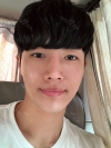 Nasal bridge+Nasal tip surgery / used nasal septum — Korea cost, reviews & before-after | MISOODA