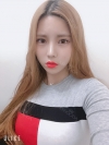 Double Eyelid Revision (Natural adhesion method+Ptosis correction+Dual Epi) + Nasal bridge + Nasal tip — Korea cost, reviews & before-after | MISOODA