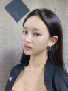 Double Eyelid Revision (Natural adhesion method+Ptosis correction) — Korea cost, reviews & before-after | MISOODA