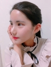 Double Eyelid Revision (Natural adhesion method+Ptosis correction+Dual Epi) + Nasal bridge + Nasal tip — Korea cost, reviews & before-after | MISOODA