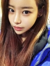 Eye surgery (Natural adhesion+ Ptosis correction) + Nasal bridge+Nasal tip — Korea cost, reviews & before-after | MISOODA