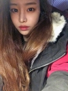 Eye surgery (Natural adhesion+ Ptosis correction) + Nasal bridge+Nasal tip — Korea cost, reviews & before-after | MISOODA