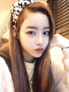 Eye surgery (Natural adhesion+ Ptosis correction) + Nasal bridge+Nasal tip — Korea cost, reviews & before-after | MISOODA