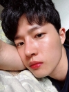 Nasal bridge+Nasal tip surgery / used nasal septum — Korea cost, reviews & before-after | MISOODA