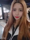 Double Eyelid Revision (Natural adhesion method+Ptosis correction+Dual Epi) + Nasal bridge + Nasal tip — Korea cost, reviews & before-after | MISOODA