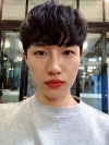 Nasal bridge+Nasal tip surgery / used nasal septum — Korea cost, reviews & before-after | MISOODA