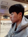 Nasal bridge+Nasal tip surgery / used nasal septum — Korea cost, reviews & before-after | MISOODA