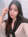 Double Eyelid Revision (Natural adhesion method+Ptosis correction+Dual Epi) + Nasal bridge + Nasal tip — Korea cost, reviews & before-after | MISOODA