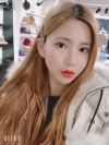 Double Eyelid Revision (Natural adhesion method+Ptosis correction+Dual Epi) + Nasal bridge + Nasal tip — Korea cost, reviews & before-after | MISOODA