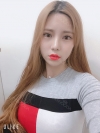 Double Eyelid Revision (Natural adhesion method+Ptosis correction+Dual Epi) + Nasal bridge + Nasal tip — Korea cost, reviews & before-after | MISOODA