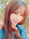 Double Eyelid Revision (Natural adhesion method+Ptosis correction) — Korea cost, reviews & before-after | MISOODA