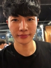 Nasal bridge+Nasal tip surgery / used nasal septum — Korea cost, reviews & before-after | MISOODA