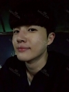 Nasal bridge+Nasal tip surgery / used nasal septum — Korea cost, reviews & before-after | MISOODA