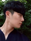 Nasal bridge+Nasal tip surgery / used nasal septum — Korea cost, reviews & before-after | MISOODA