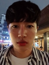 Nasal bridge+Nasal tip surgery / used nasal septum — Korea cost, reviews & before-after | MISOODA