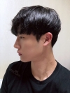 Nasal bridge+Nasal tip surgery / used nasal septum — Korea cost, reviews & before-after | MISOODA