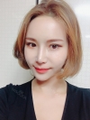 Double Eyelid Revision (Natural adhesion method+Ptosis correction) — Korea cost, reviews & before-after | MISOODA