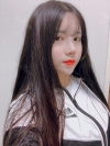 Double Eyelid Revision (Natural adhesion method+Ptosis correction+Dual Epi) + Nasal bridge + Nasal tip — Korea cost, reviews & before-after | MISOODA