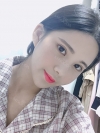 Double Eyelid Revision (Natural adhesion method+Ptosis correction+Dual Epi) + Nasal bridge + Nasal tip — Korea cost, reviews & before-after | MISOODA