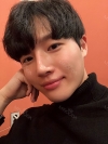 Nasal bridge+Nasal tip surgery / used nasal septum — Korea cost, reviews & before-after | MISOODA