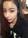 Eye surgery (Natural adhesion+ Ptosis correction) + Nasal bridge+Nasal tip — Korea cost, reviews & before-after | MISOODA