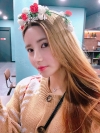 Double Eyelid Revision (Natural adhesion method+Ptosis correction+Dual Epi) + Nasal bridge + Nasal tip — Korea cost, reviews & before-after | MISOODA