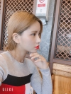 Double Eyelid Revision (Natural adhesion method+Ptosis correction+Dual Epi) + Nasal bridge + Nasal tip — Korea cost, reviews & before-after | MISOODA