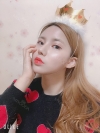 Double Eyelid Revision (Natural adhesion method+Ptosis correction+Dual Epi) + Nasal bridge + Nasal tip — Korea cost, reviews & before-after | MISOODA