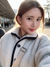Double Eyelid Revision (Natural adhesion method+Ptosis correction+Dual Epi) + Nasal bridge + Nasal tip — Korea cost, reviews & before-after | MISOODA