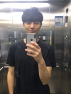 Nasal bridge+Nasal tip surgery / used nasal septum — Korea cost, reviews & before-after | MISOODA