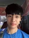 Nasal bridge+Nasal tip surgery / used nasal septum — Korea cost, reviews & before-after | MISOODA