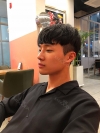 Nasal bridge+Nasal tip surgery / used nasal septum — Korea cost, reviews & before-after | MISOODA