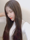 Double Eyelid Revision (Natural adhesion method+Ptosis correction+Dual Epi) + Nasal bridge + Nasal tip — Korea cost, reviews & before-after | MISOODA