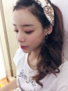 Eye surgery (Natural adhesion+ Ptosis correction) + Nasal bridge+Nasal tip — Korea cost, reviews & before-after | MISOODA