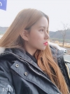 Double Eyelid Revision (Natural adhesion method+Ptosis correction+Dual Epi) + Nasal bridge + Nasal tip — Korea cost, reviews & before-after | MISOODA