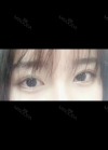 22 year old double eyelid check my photos — Korea cost, reviews & before-after | MISOODA