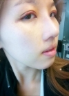 Plastic glasses?? No problem!! — Korea cost, reviews & before-after | MISOODA