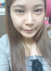 Sparkly eyes! — Korea cost, reviews & before-after | MISOODA