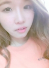 Plastic glasses?? No problem!! — Korea cost, reviews & before-after | MISOODA