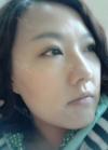 Incision double eyelid surgery, epi and lateral canthoplasty, Jawline toxin — Korea cost, reviews & before-after | MISOODA