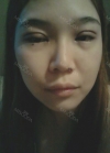 Sparkly eyes! — Korea cost, reviews & before-after | MISOODA
