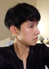 TYPES OF SURGERY: V-LINE, NOSE REVISION, NOSTRIL REDUCTION & FAT GRAFTING — Korea cost, reviews & before-after | MISOODA