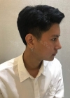TYPES OF SURGERY: V-LINE, NOSE REVISION, NOSTRIL REDUCTION & FAT GRAFTING — Korea cost, reviews & before-after | MISOODA
