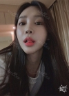 Endotine thread lifting, Epicanthoplasty, Nose revision surgery, lip tip lift — Korea cost, reviews & before-after | MISOODA