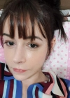 Rhinoplasty + Fat graft + PRP + Eye bag removal + Thread Lift + Lip Filler — Korea cost, reviews & before-after | MISOODA