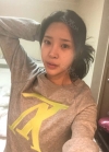 Endotine thread lifting, Epicanthoplasty, Nose revision surgery, lip tip lift — Korea cost, reviews & before-after | MISOODA