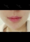 I absolutely love my lips!!! — Korea cost, reviews & before-after | MISOODA