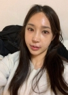 Endotine thread lifting, Epicanthoplasty, Nose revision surgery, lip tip lift — Korea cost, reviews & before-after | MISOODA