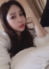 Endotine thread lifting, Epicanthoplasty, Nose revision surgery, lip tip lift — Korea cost, reviews & before-after | MISOODA